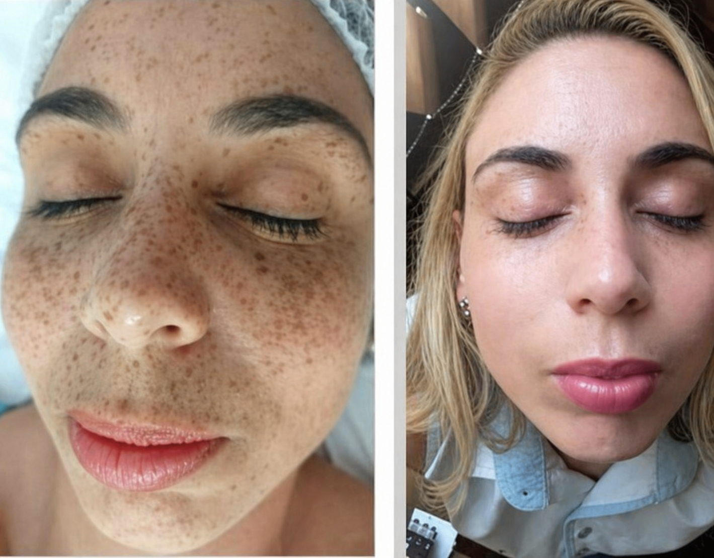 Resultado antes e depois 6
